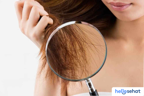 Atasi Rambut Bercabang: Penyebab dan Solusi Ampuh Sekarang