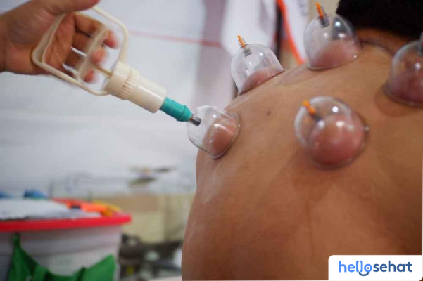 Bekam Kolesterol: 5 Tanda Ampuh Darah Bersih Terlihat
