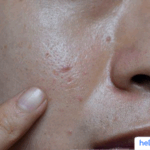 Rahasia Kulit Glowing: Atasi Sel Kulit Mati Sekarang!