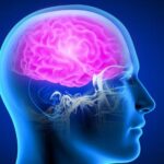 Silent Stroke: Bahaya Stroke Tanpa Gejala yang Mematikan