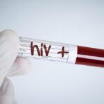 Waspada! Kasus HIV di Indonesia Tembus 564 Ribu Tahun 2025